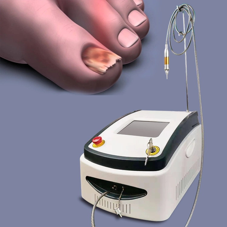 Laseev Yaser Best Class IV Laser Onychomycosis Laser Podiatry Physiotherapy Equipments Nail Fungus Pain Relief Treatment