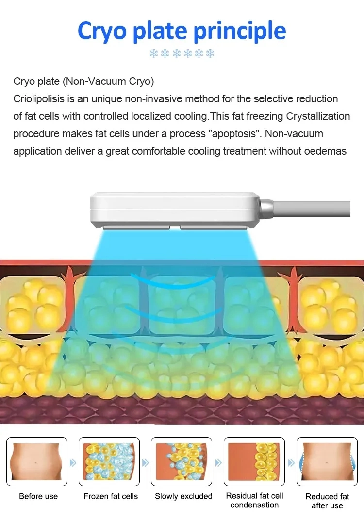 Cryopads &amp; Thermal Shock System, Cryotherapy Slimming and Shockwave Machine