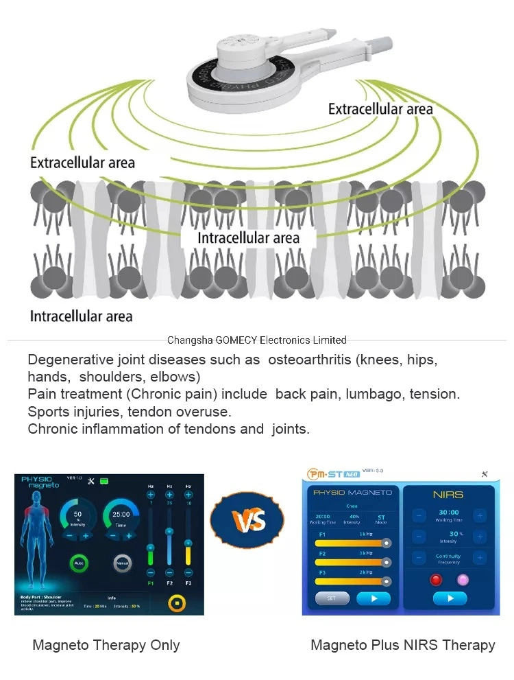 Magneto Therapy Physio Magneto Teletherapy Pulsed Electromagnetic Field Super Transduction Machine