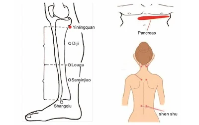Physiotherapie Verringerung der hohen Blutzucker und Diabetiker Komplikation Therapie Millimeter Wave-Gerät