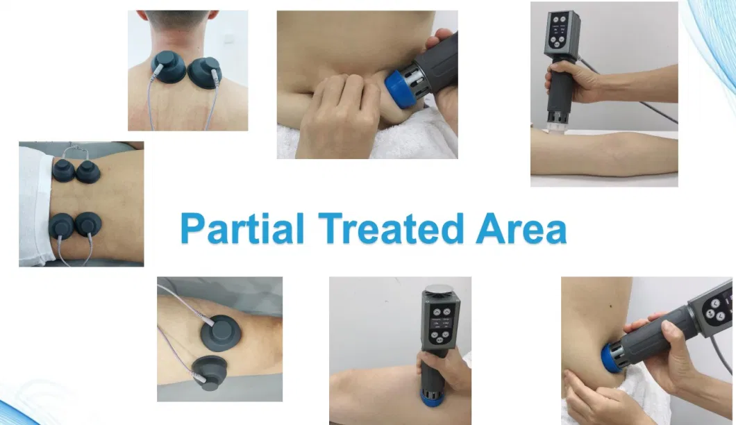 Pain Relieving Mobility Restoration Acceleration of Healing Shockwave Eswt Machine