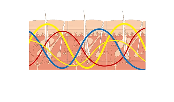 Variable Frequency Therapy System Frequency-Modulated Therapy Device