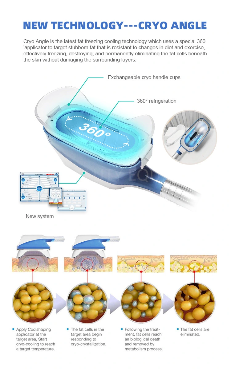 4 Cryo Handles Work Together 360 Cooling Cryolipolysis Cold Body Slimming Cavitation RF Lipo Laser Liposuction