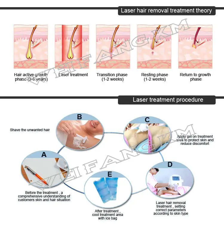 High Quality 808nm Diode Laser Treatment Machine for Pain Relief