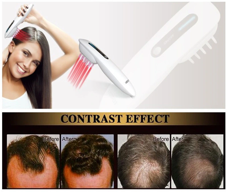 Infrared Laser Acupuncture LED Hair Regeneration Machine Biological Laser Treatment of Hair Loss