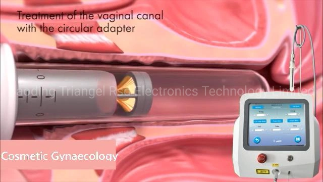 980+1470nm Vaginal Tightening Vaginal Rejuvenation Laser Gynecological Wand Laser Therapy Device