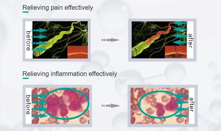 Cold Laser Therapy Device Treatment Body Pain Relief Sports Injuries