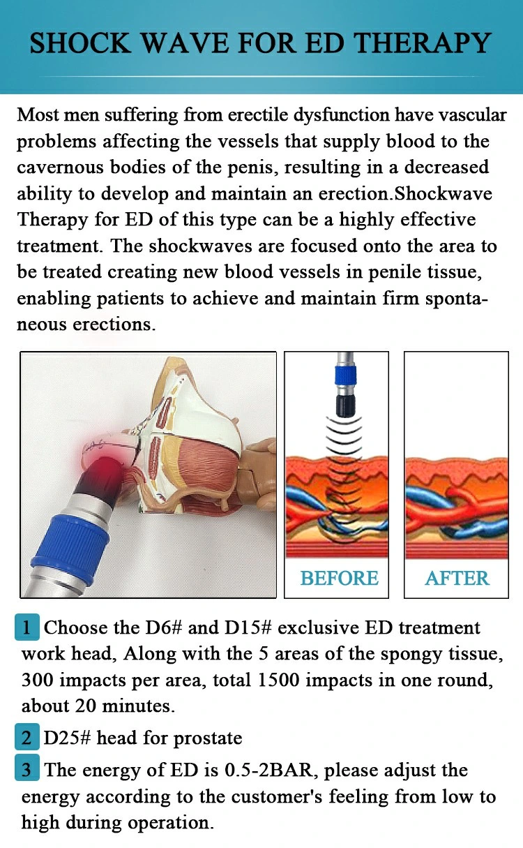 Shock Wave Therapy Portable ED Machine Physiotherapy Reduce Pain Equipment