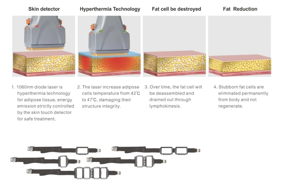 Body Sculpting Sculpture 1060nm Laser Diode Fat Removal Slimming Device