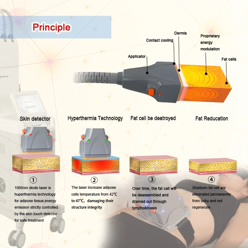 Body Sculpting Sculpture Laser Fat Removal Slimming Device with Good Performance