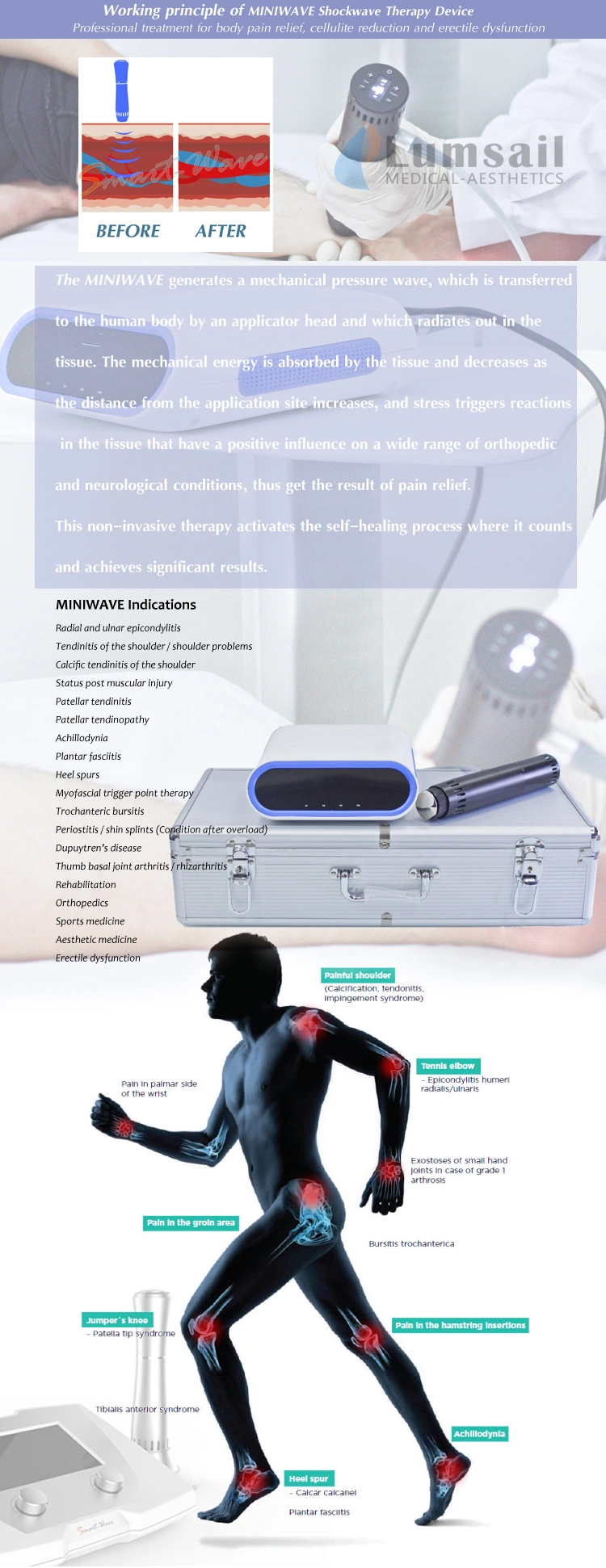 OEM/ODM Miniwave Radial Pulse Wave Therapy Device / Acoustic Wave Therapy Machine