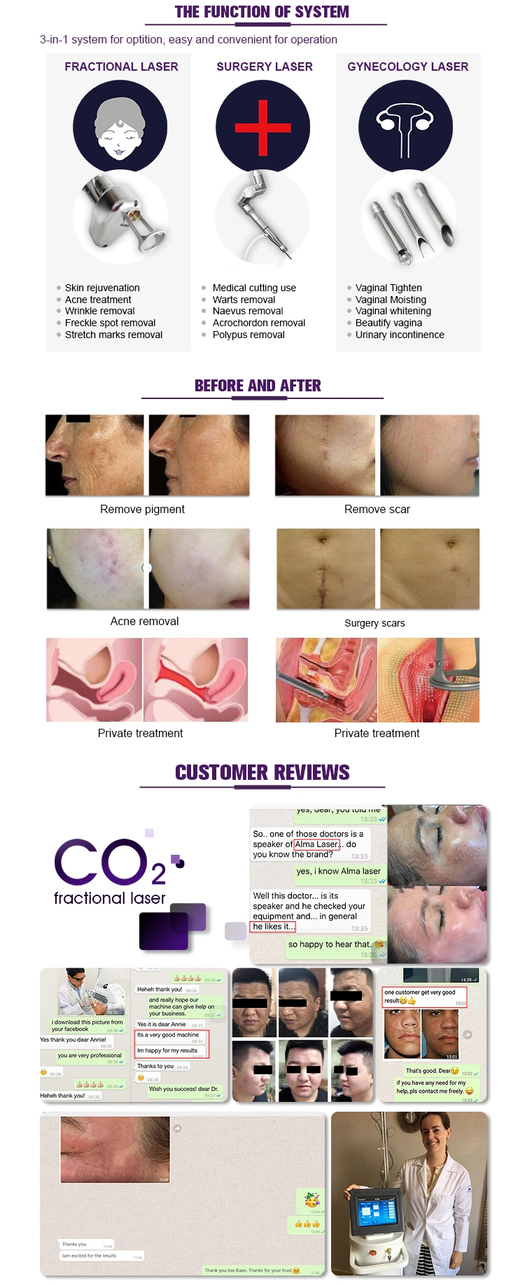 Vaginal Rejuvenation RF CO2 Fractional Laser for Acne Scars