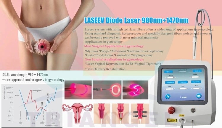 980+1470nm Vaginal Tightening Vaginal Rejuvenation Laser Gynecological Wand Laser Therapy Device