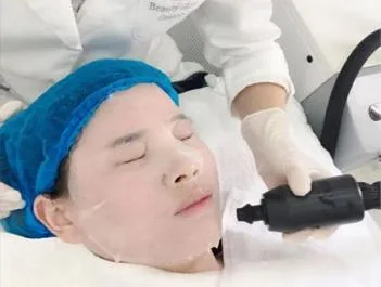 Laser Treatment Pain Relieve Cold Air Skin Cooling for IPL CO2 Laser