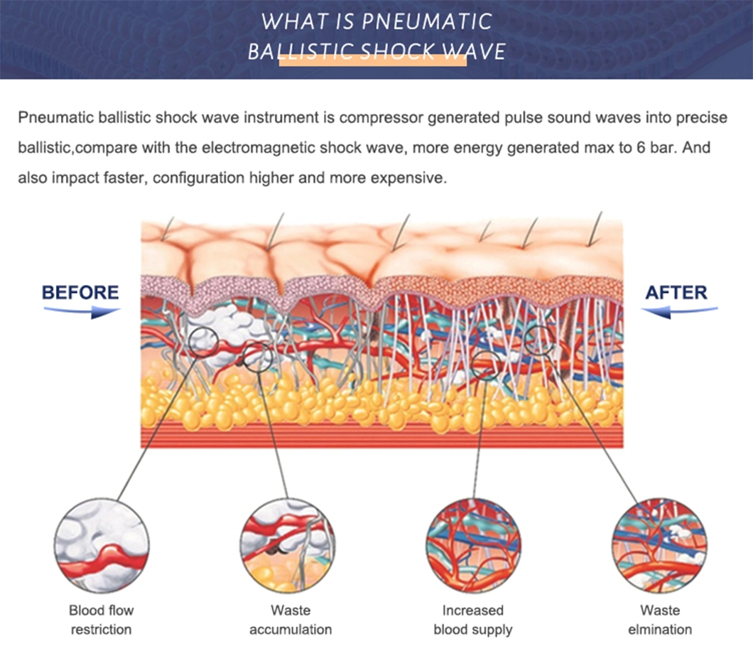 Pneumatic Portable Shockwave Therapy Device ED Erectile Dysfunction Joint Pain Relief