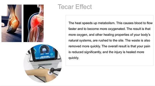Portable Pain Relief Machine 3 in 1 Smart Tecar Pain Relief Physical Therapy Cellulite Removal Shockwave for ED Treatment