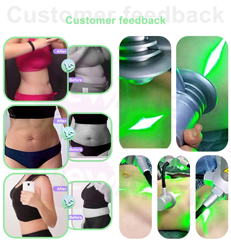 Slimming Body Fat Removal 6 in 1 160MW Cryo Cold Light Green Lipolysis 6D Lipolaser Lipolsis Professional Slimming 6D Laser Machine