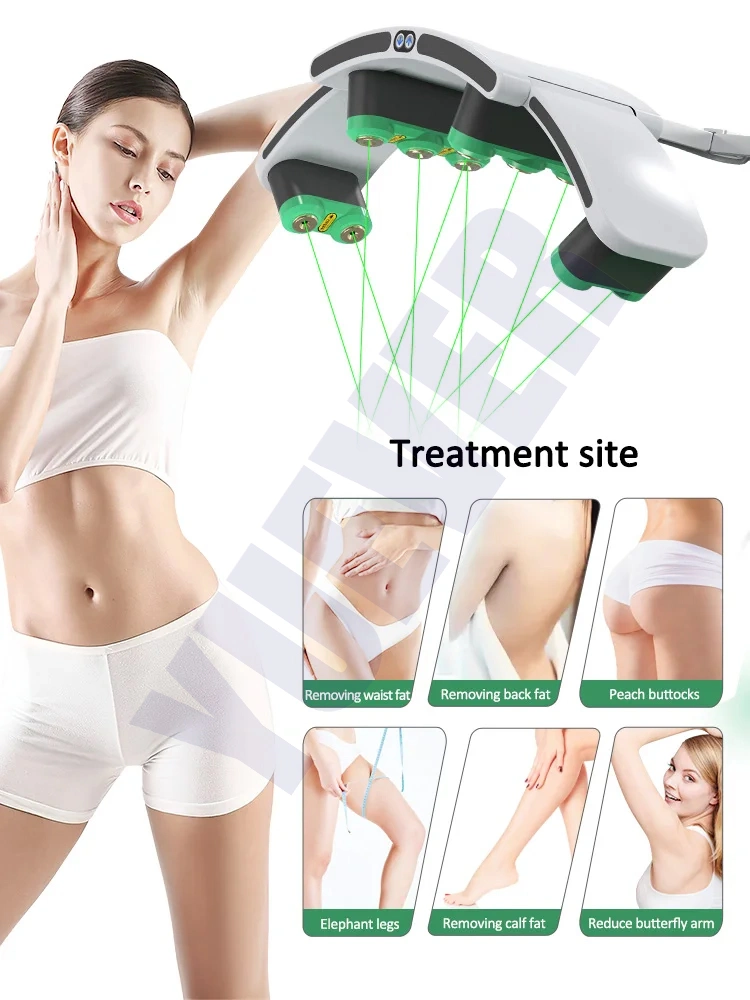 10d Lipo Laser Fat Removal 10d Cellulite Reduction 532nm Green Light Therapy Cold Laser Fast Slim Machine for Beauty
