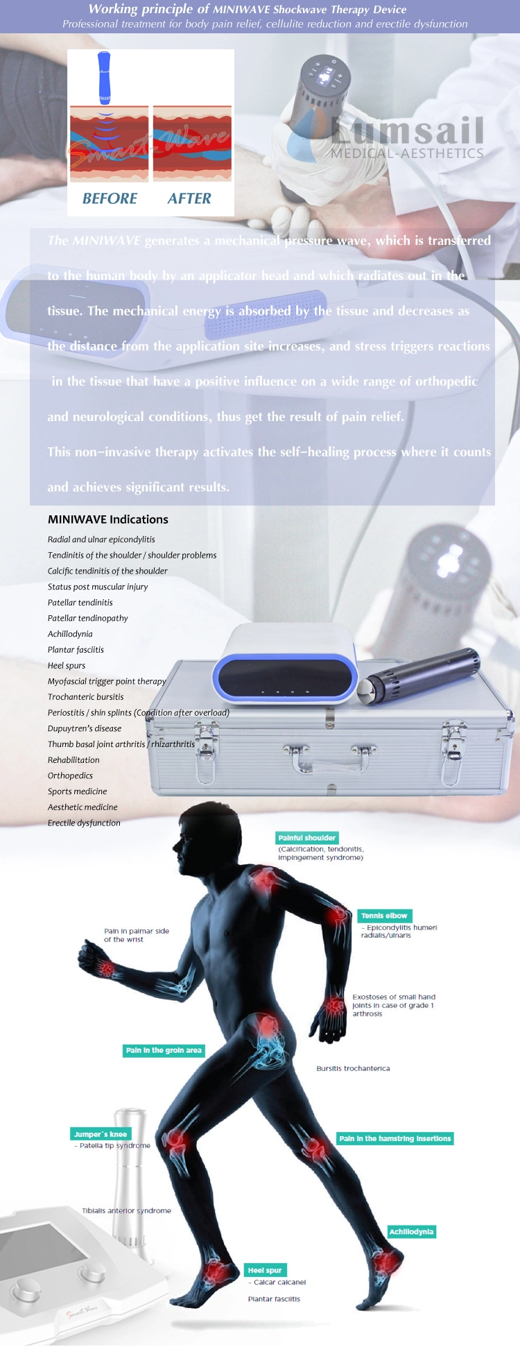 Shock Wave Therapy Equipment Machine for Leg Knee Pain Relief
