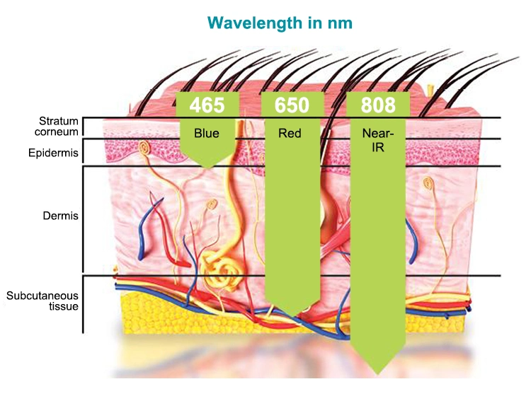 Knead Relax Muscle Laser Therapy for Arthritis