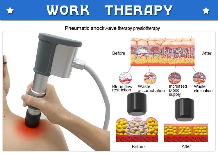 Smart Tecar Shockwave Therapy Ultrasound Physiotherapy Ultrasound Ret Cet Machine