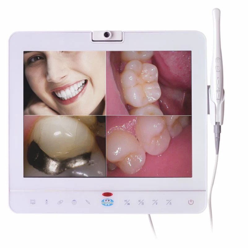 Professional WiFi Wire Intraoral Camera with White Monitor