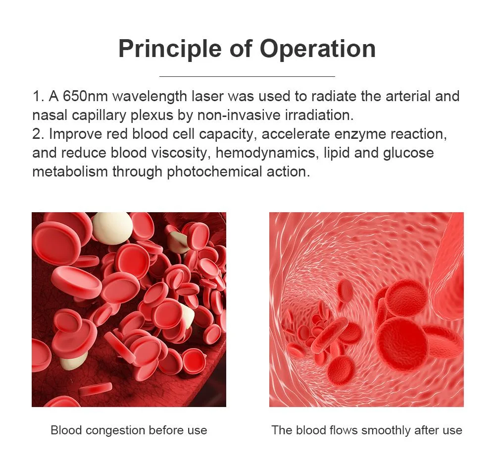 Suyzeko Semiconductor Blood Purification Cold Laser Therapy Watch for Diabetes Cure