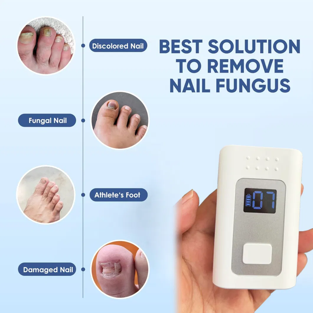 Portable Rechargeable 905nm 470nm Blue Light Finger Nail Fungus Laser Therapy Device