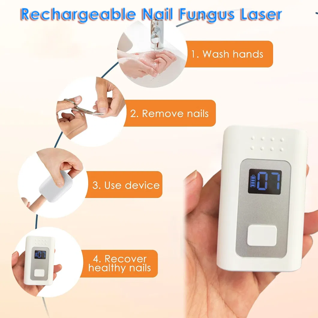 Portable Rechargeable 905nm 470nm Blue Light Finger Nail Fungus Laser Therapy Device