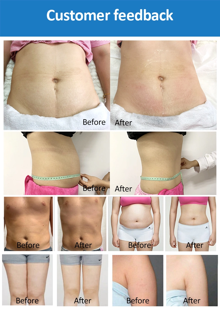 6D Laser Lipo Slimming EMS Cryo Shaping 635nm Cold Laser Fat Burning Cellulite Removal Lipo Laser