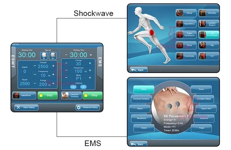 2 in 1 Shockwave EMS and Tecar Physiotherapy Device Body Care Physical Therapy Shock Waves