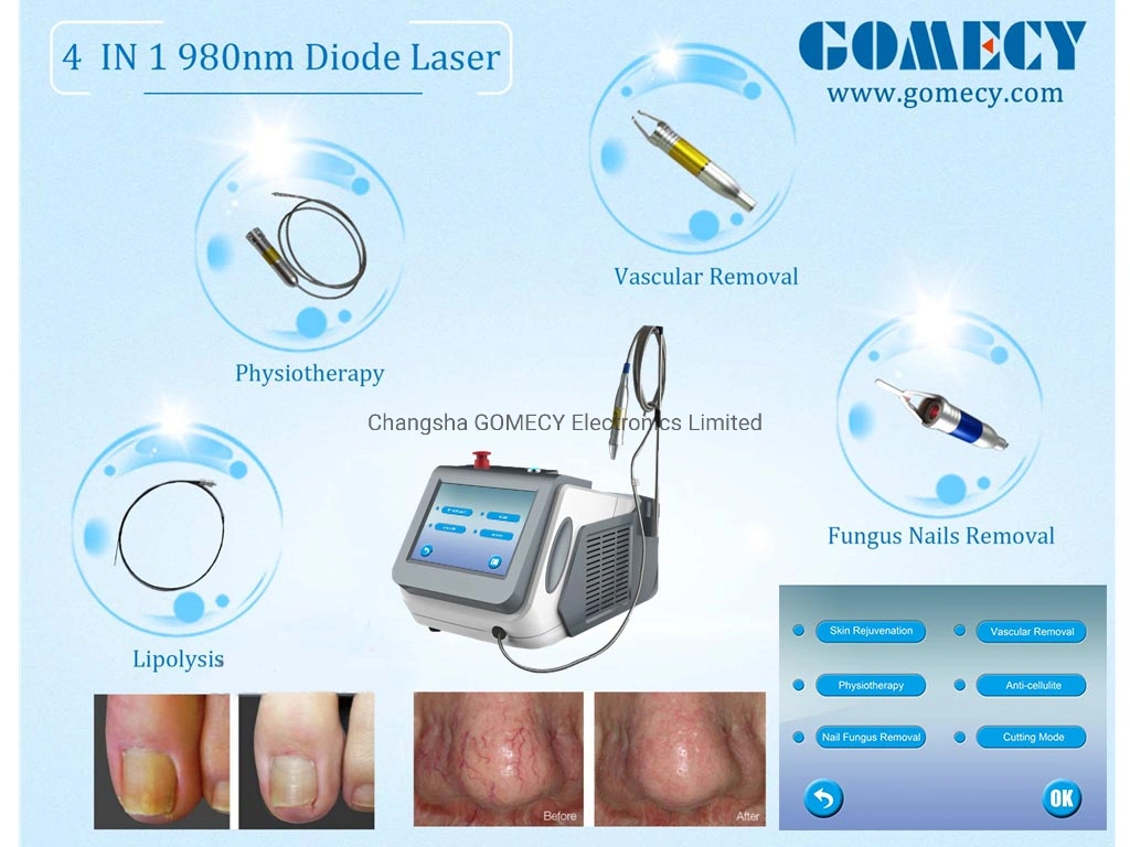 Class 4 Laser High Power 60W for Physical Therapy Pain Relief Diode Laser 980nm Machine