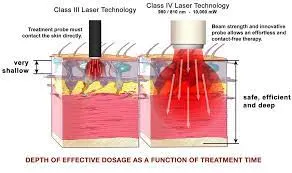 High Power Laser Therapy Cold Laser Therapy Pain Management Wound Healing Class IV Laser Therapy Equipment Deep Device for Athlete