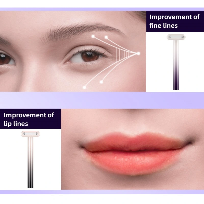 EMS Lift Instrument Anti-Wrinkle Anti Aging RF Eye Massager Wand Dark Circles Eye Bags Wrinkle Remover Eye Care Beauty Device