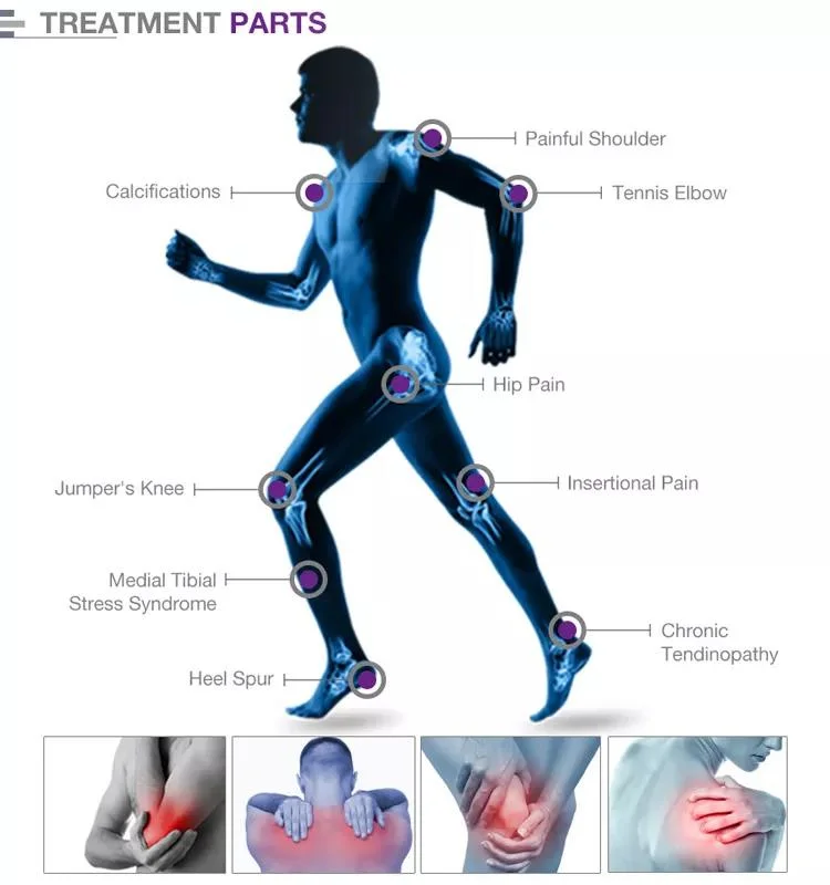 Shockwave Body Pain Reduce Ultrasound Portable Physical Therapy Machine/Physical Shock Wave Therapy Equipments Pain Treatment Shockwave Therapy Machine Device