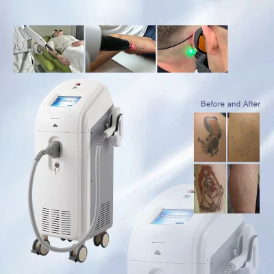 protección del medio ambiente rentable tatuaje Qswitched Q-Switched Nd YAG máquina de láser de eliminación de manchas de avena
