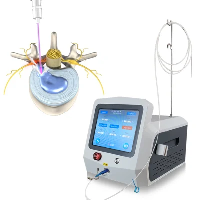 2021 China Analgésico Artritis+1470980/980 nm láser sin dolor Pldd láser frío