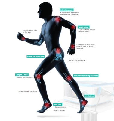 1-5 Bar Shockwave Impotencia Tratamiento de Fisioterapia de Onda de Choque de la Máquina para el Alivio del Dolor