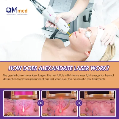 Qm Venta caliente profesional Alexandrite Laser depilación 755nm 1064nm Alexandrite láser para Salon SPA con dispositivo de enfriamiento de la piel Alexandrite Láser de eliminación del vello