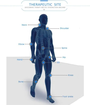 Shockwave estimulador máquina corporal FDA CE SPA equipos de fisioterapia choque Clínica