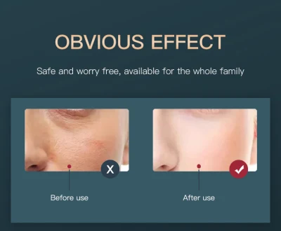 Lámpara LED UV profesional Nano Spray EMS Masaje Anti Envejecimiento Beauty Skin Blue Red LED Face Light Therapy Machine