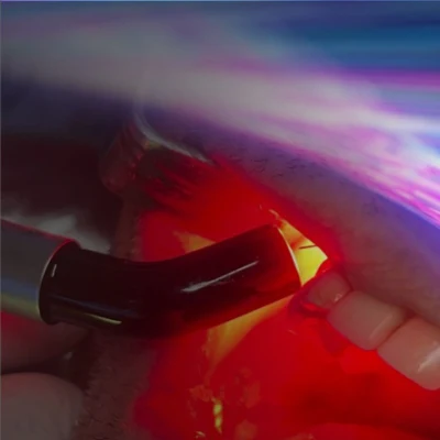 Gran oferta, corte de tejido blando de bajo nivel, tratamiento de odontología, máquina láser Dental médica 980nm