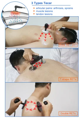 Smart Tecar terapia diatermia máquina Cet Ret terapia de onda de choque de RF el alivio del dolor