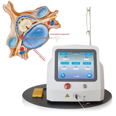 2021 China Analgésico Artritis+1470980/980 nm láser sin dolor Pldd láser frío
