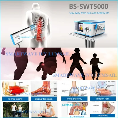 La CE Aprobó los Equipos de Fisioterapia de la Máquina para el Tratamiento del Dolor de Shockwave Shockwave Eswt
