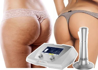 Tratamiento Celulitis Eficaz Equipo de Terapia de Onda Acústica para el Cuerpo Adelgaza