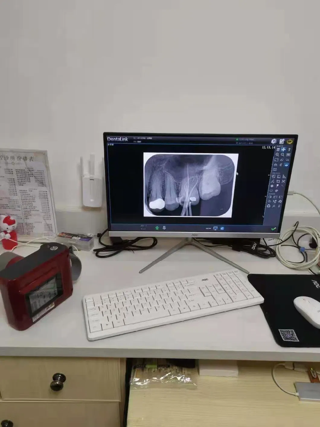 Dental Portable Frequency X Ray Machine Digital Dental X-ray Unit