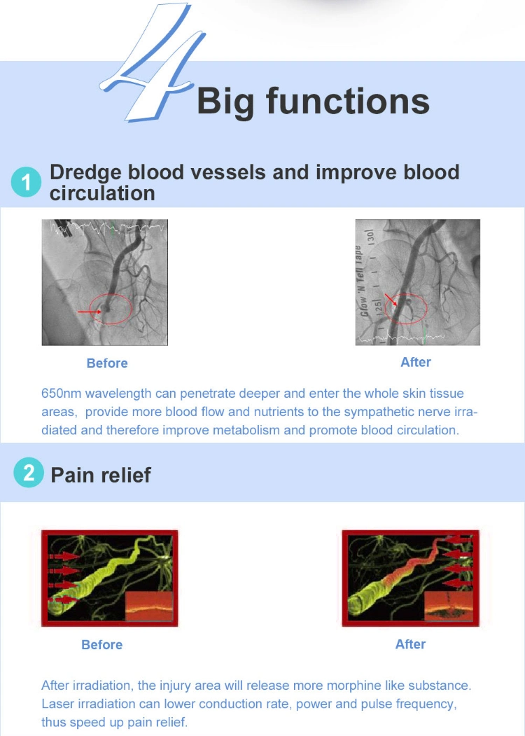 Electronic Low Level Cold Laser Therapy for Body Health Care