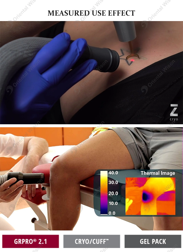Longest Piezo Shockwav ED Treatment Zimmer Shockwave Therapy Acoustic Wave Pain Release Device