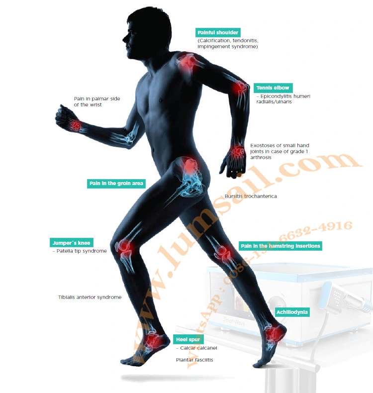 Ce Approved Physical Therapy Equipments Shockwave Machine for Pain Treatment Eswt Shockwave